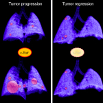 La eliminación de c-Raf induce la regresión de los tumores de pulmón avanzados en modelos de ratón. Foto CNIO